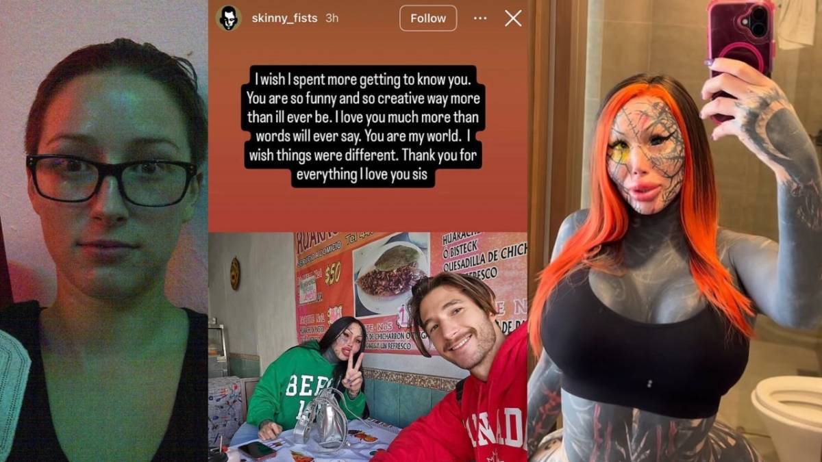 Estetik Bağımlısı Fenomen Mary Magdalene'in Hayatını Kaybetti: Sosyal Medyadaki Son Paylaşımı!