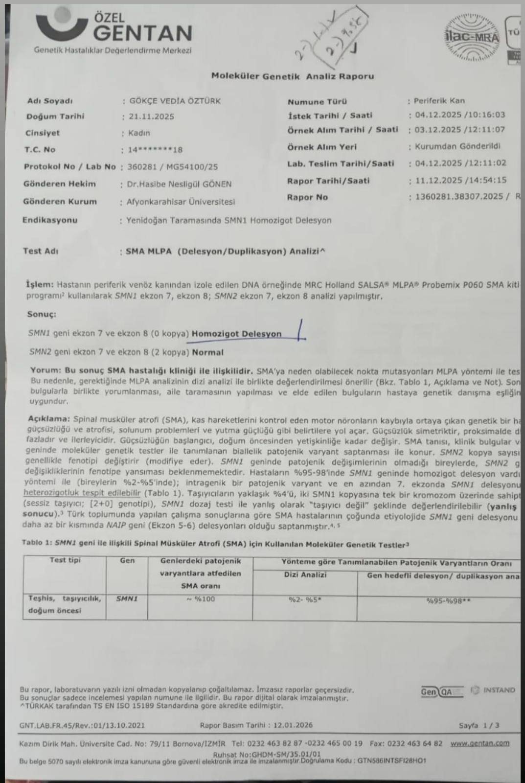 Afyonkarahisar’da Minik Gökçe SMA Tip-1 ile Zamanla Yarışıyor