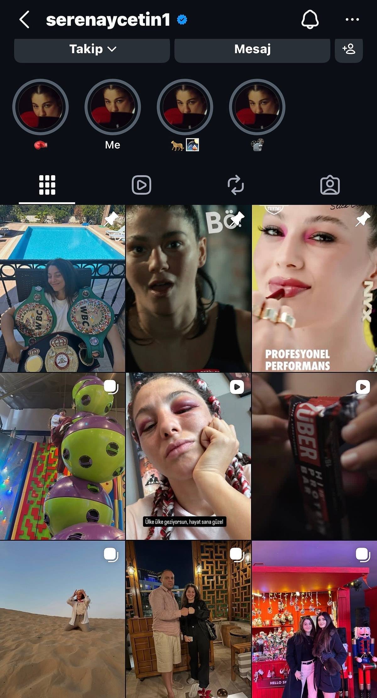 Survivor 2026’da Diskalifiye Şoku: Seren Ay Çetin’den Dikkat Çeken İlk Hamle!